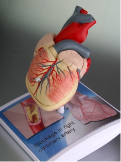 Szív modell Szív modell